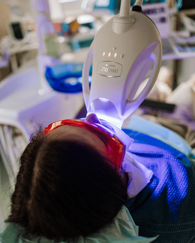 Albire dentară profesională Philips Zoom realizată în clinică la Fogklinika
